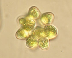 Coelastrum green algae (phytoplankton)