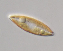 Pennate diatom (phytoplankton)