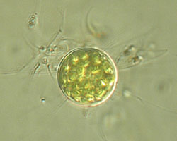 Centric diatom (phytoplankton)