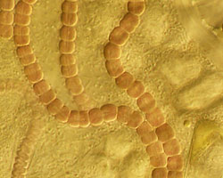 Filamentous cyanobacteria (phytoplankton)