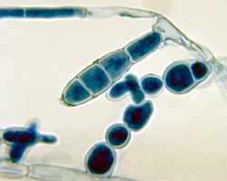 Epidermophyton floccosum fungus that causes athlete's foot
