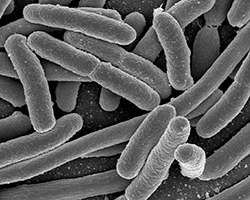 A microscopic view of the bacteria E. coli.