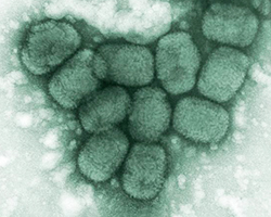 Smallpox viruses shown under an electronic microscope