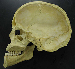 skull case