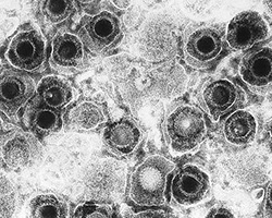 A transmission electron micrograph of herpes virus