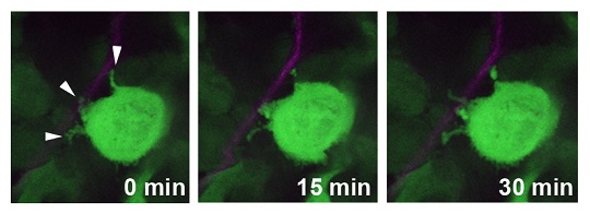 a green cancer cell is shown in three different windows, going from left to right. The first window (left) is time 0, and the right-most window is after 30 minutes. Over time, the cancer cell slowly grows invadopodia, which are shown as small green projections coming off the larger cancer cell body.