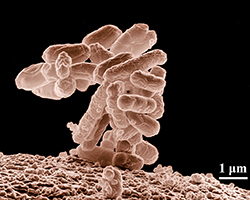 E coli bacteria seen through a microscope