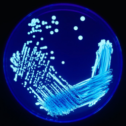 Picture of Legionella bacteria on an agar plate with ultraviolet light.