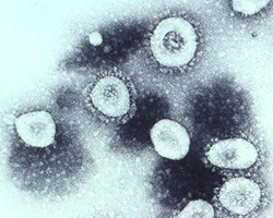 Microscopy image of coronavirus