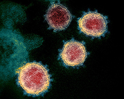 A microscopic view of SARS-Cov-2, the virus that causes the coronavirus.