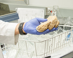 Diego Mastroeni holding part of a brain