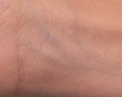 THe veins of the wrist, looking blue through light colored skin