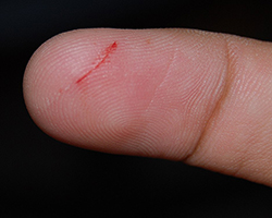 The tip of a finger with a papercut, with red blood showing along the cut
