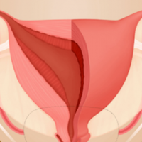 Illustrated image of a uterus