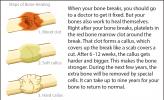 The stages of bone healing.