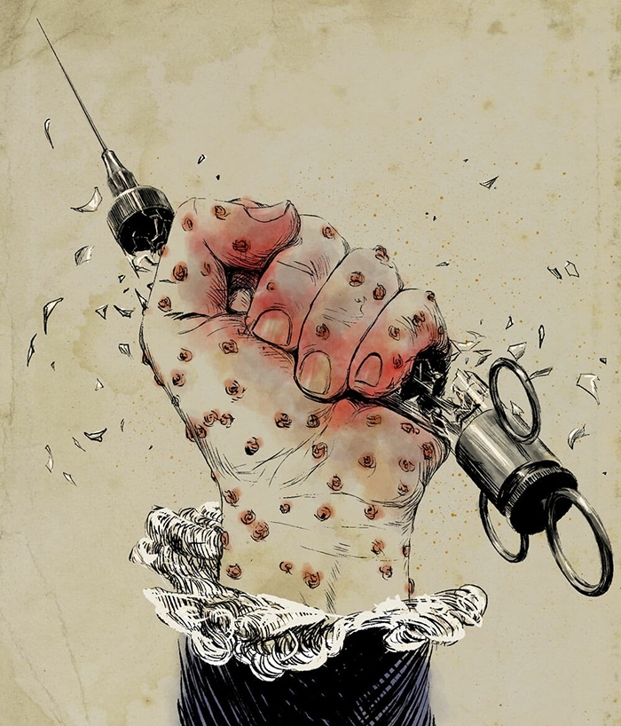 Ilustración de Clay Rodery que muestra un puño infectado con viruela rompiendo una jeringa de vidrio