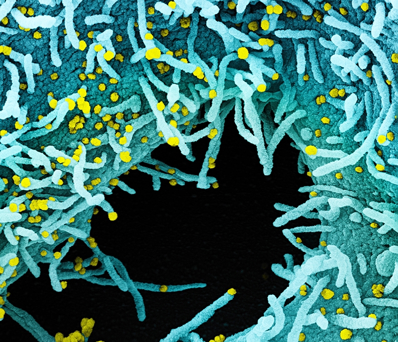 Imagem colorida de COVID-19 amarelo causando vírus anexados às células