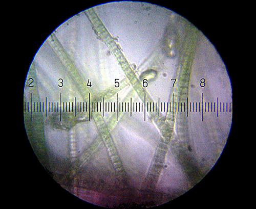 Cyanobacteria under a microscope