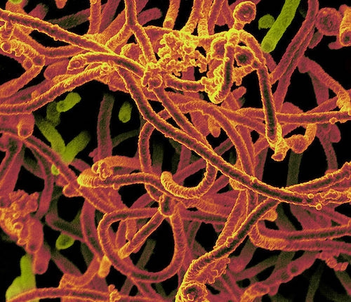 Ebola virus image links to Top Question
