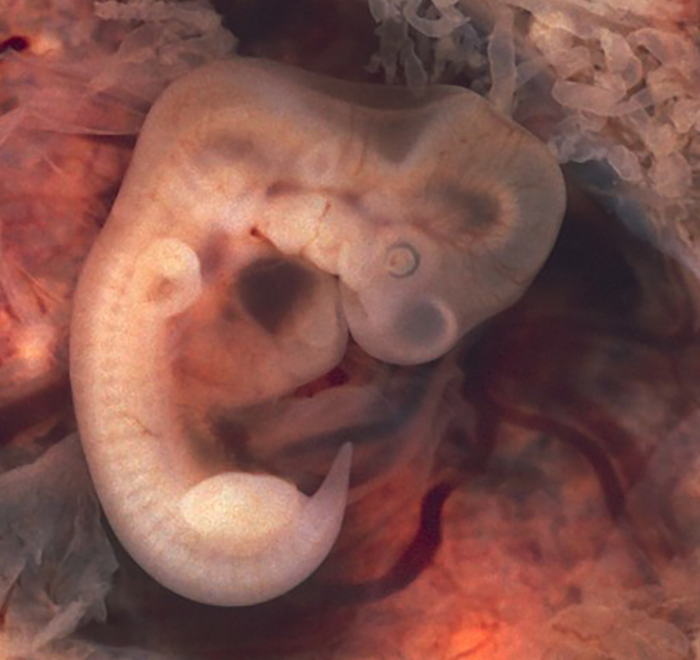 A human embryo in its 7th week of development inside the body