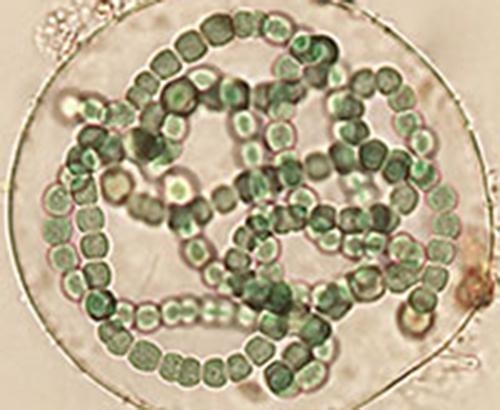 Filamentous cyanobacteria