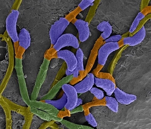 alınan mantar hifinin ve sporların elektron mikroskobu ile gösterimi