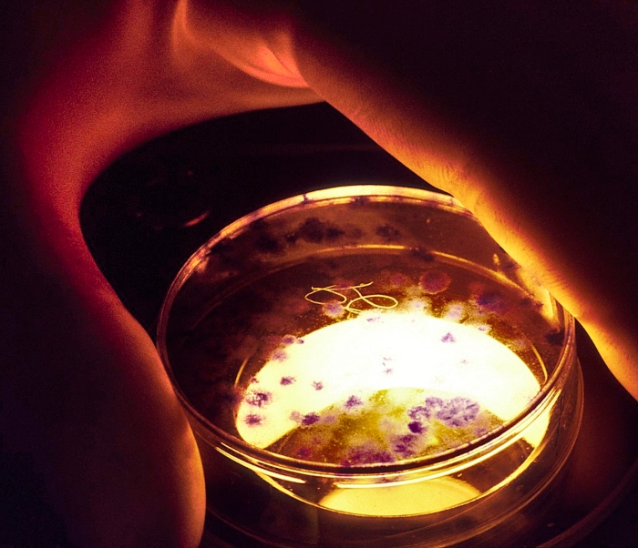 a hand holds a petri dish of cells in the dark, with light shining from the bottom