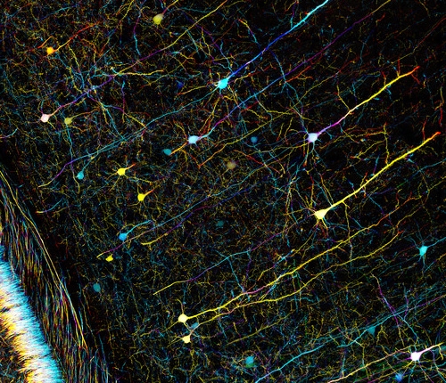 nervous tissue in mouse brain