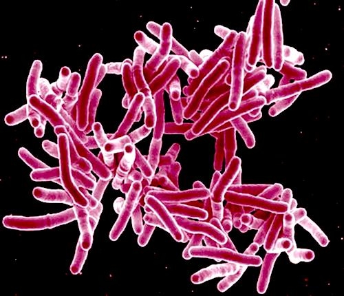 Mycobacterium tuberculosis, the bacteria that causes tuberculosis