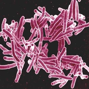 Tuberculose resistente a múltiplas drogas