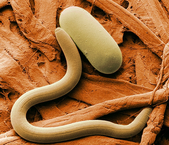 A microscopic nematode with its egg