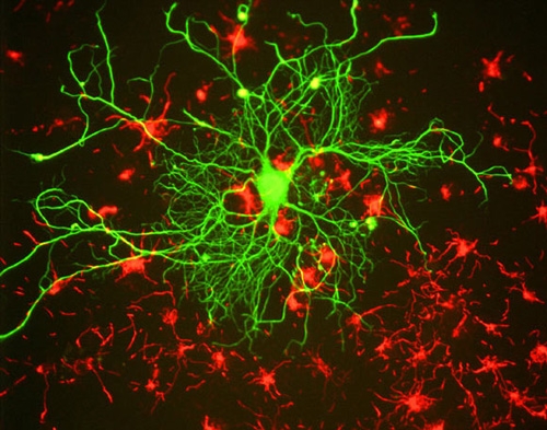 Cortical neuron stained with antibody to neurofilament subunit NF-L in green.