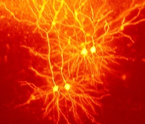 Immagine di neuroni colorati con colorante fluorescente.