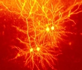 Флуоресцентний барвник показує деякі пірамідні нейрони.