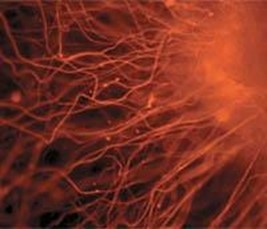 Диференційовані нервові клітини з помаранчевим флуоресцентним барвником.
