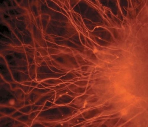 Immagine di un neurone colorato fluorescente in crescita.