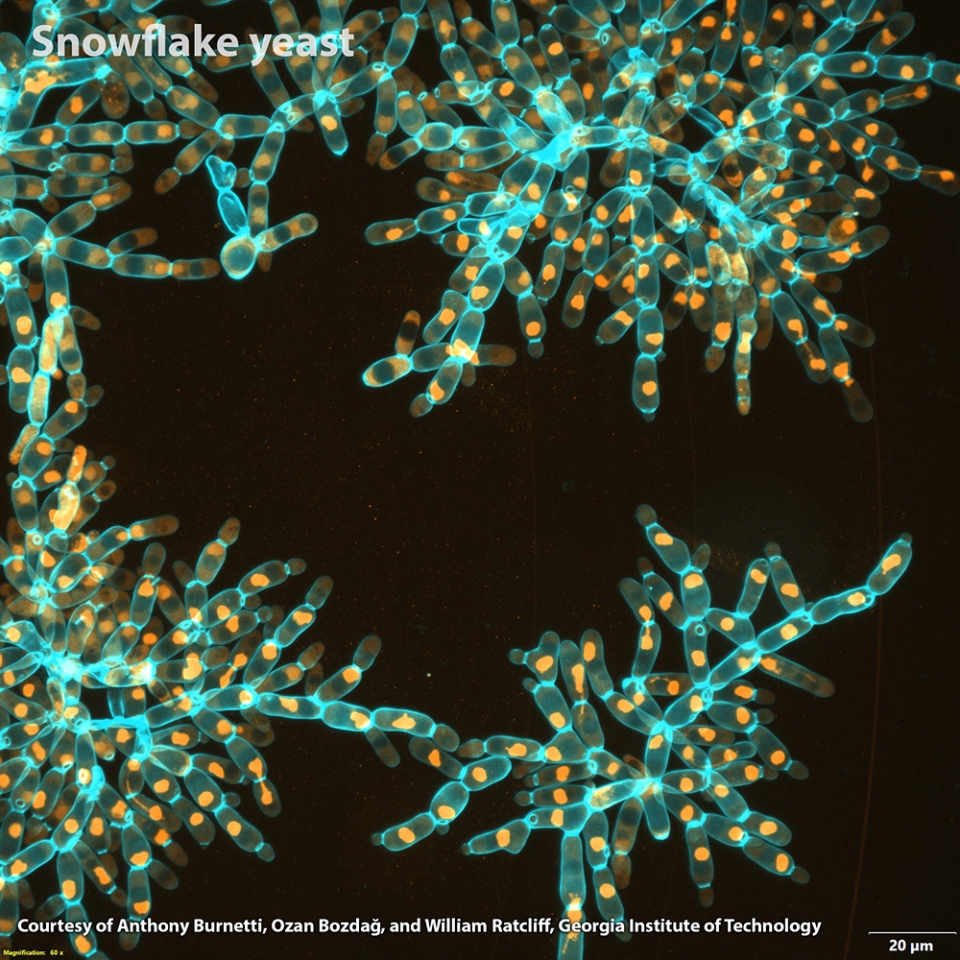 Snowflake yeast microscope image of glowing cells.