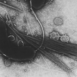 A microscopic image of vibrio cholerae