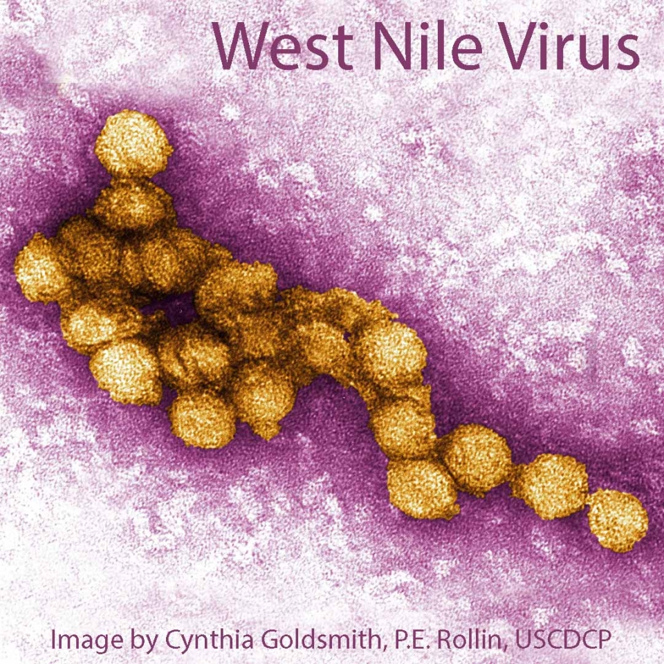 Microscope image of West Nile virus.