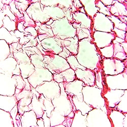 White adipose tissue